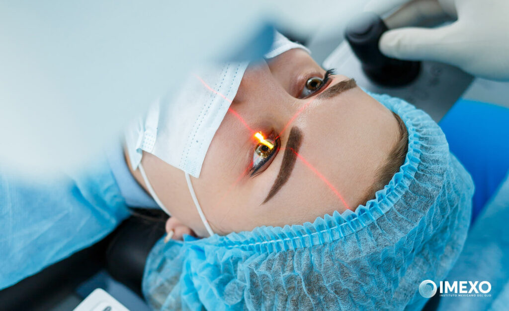 La cirugía refractiva láser más conocida es LASIK.